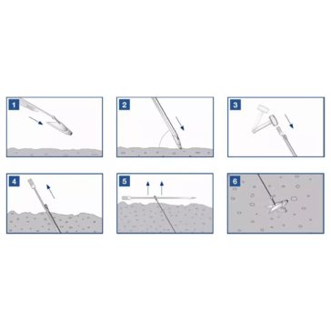 GRIPPLE® végoszlop feszítő horgony Anchor3